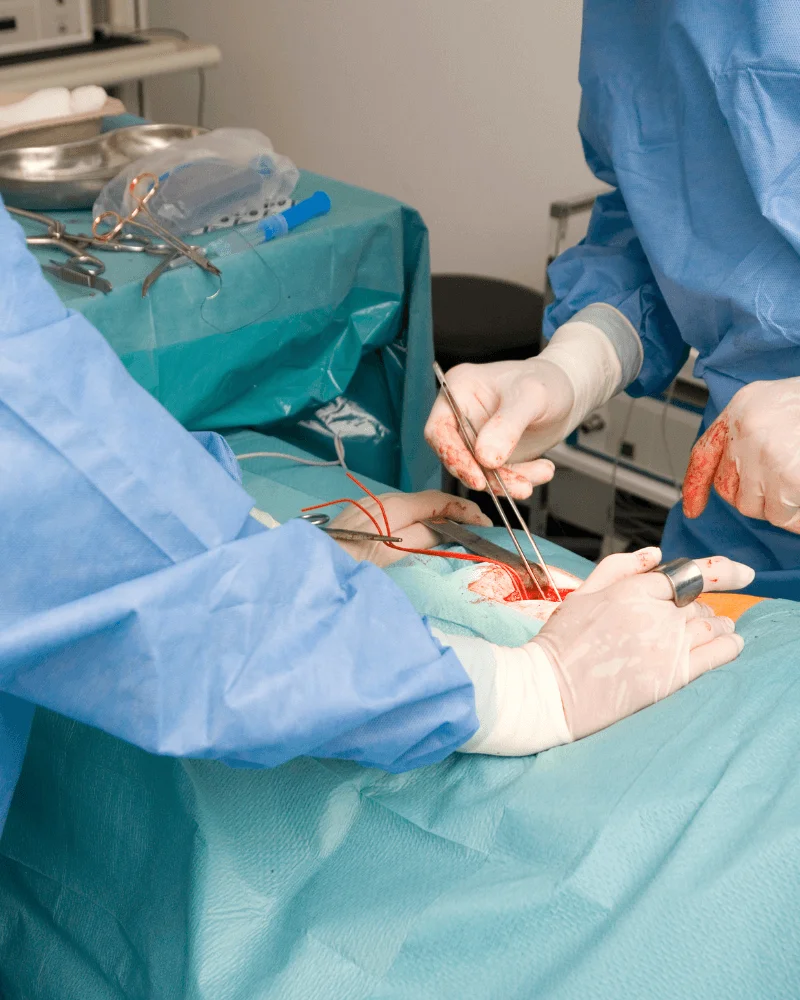 cirujano-de-hernias-en-Zapopan